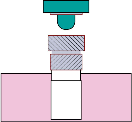 Overweight Tip - 5/16-inch long 